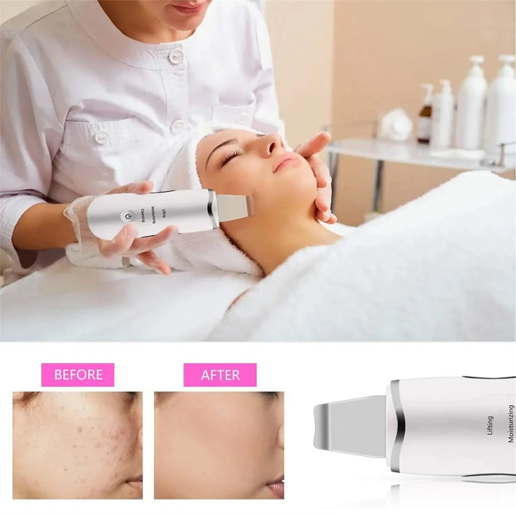 Ultrasonic Facial Spatula Deep Cleansing Skin Scrubber