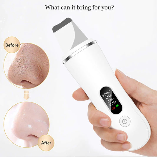 New Ultrasonic Skin Scrubber Cleansing Blackheads Daily